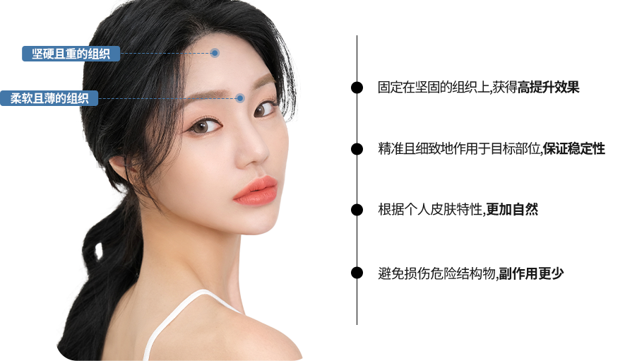 눈썹거상리프팅
